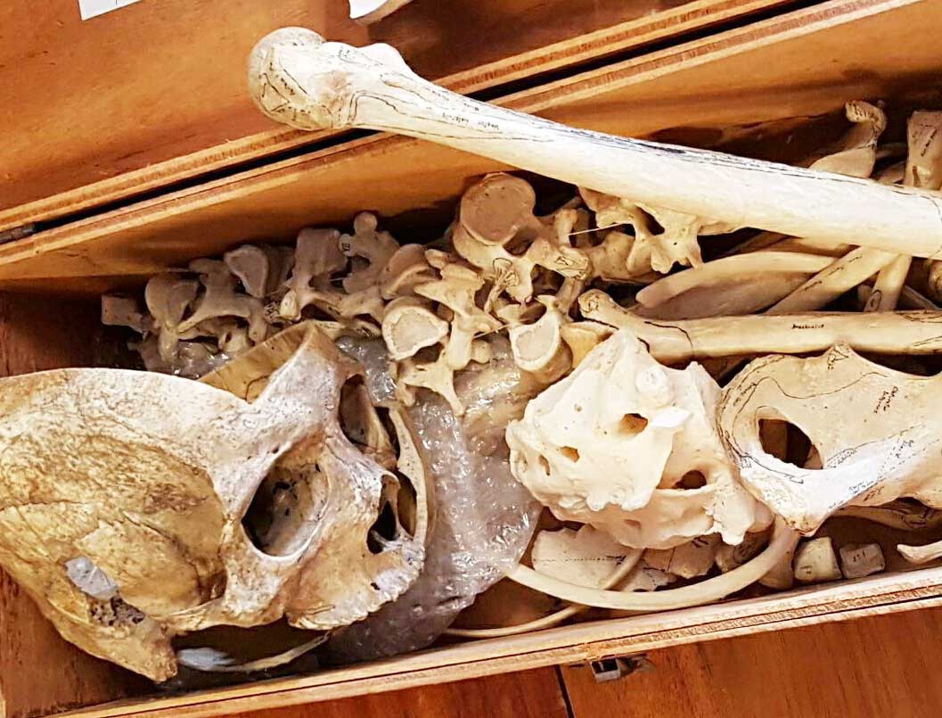 Human remains with a skull and bones Human remains with a skull and bones